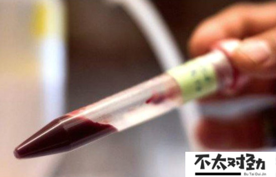 世界第一款人造血液来袭，适合任何血型，可保存一年以上